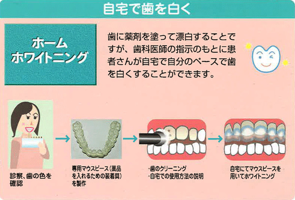 ホワイトニングの主な種類と方法